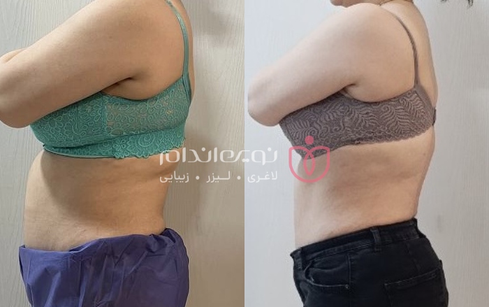 مجموعه زیبایی و لاغری نوین